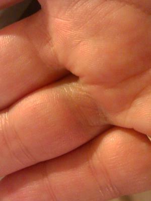 Why Sterling Silver Turns Black or Green