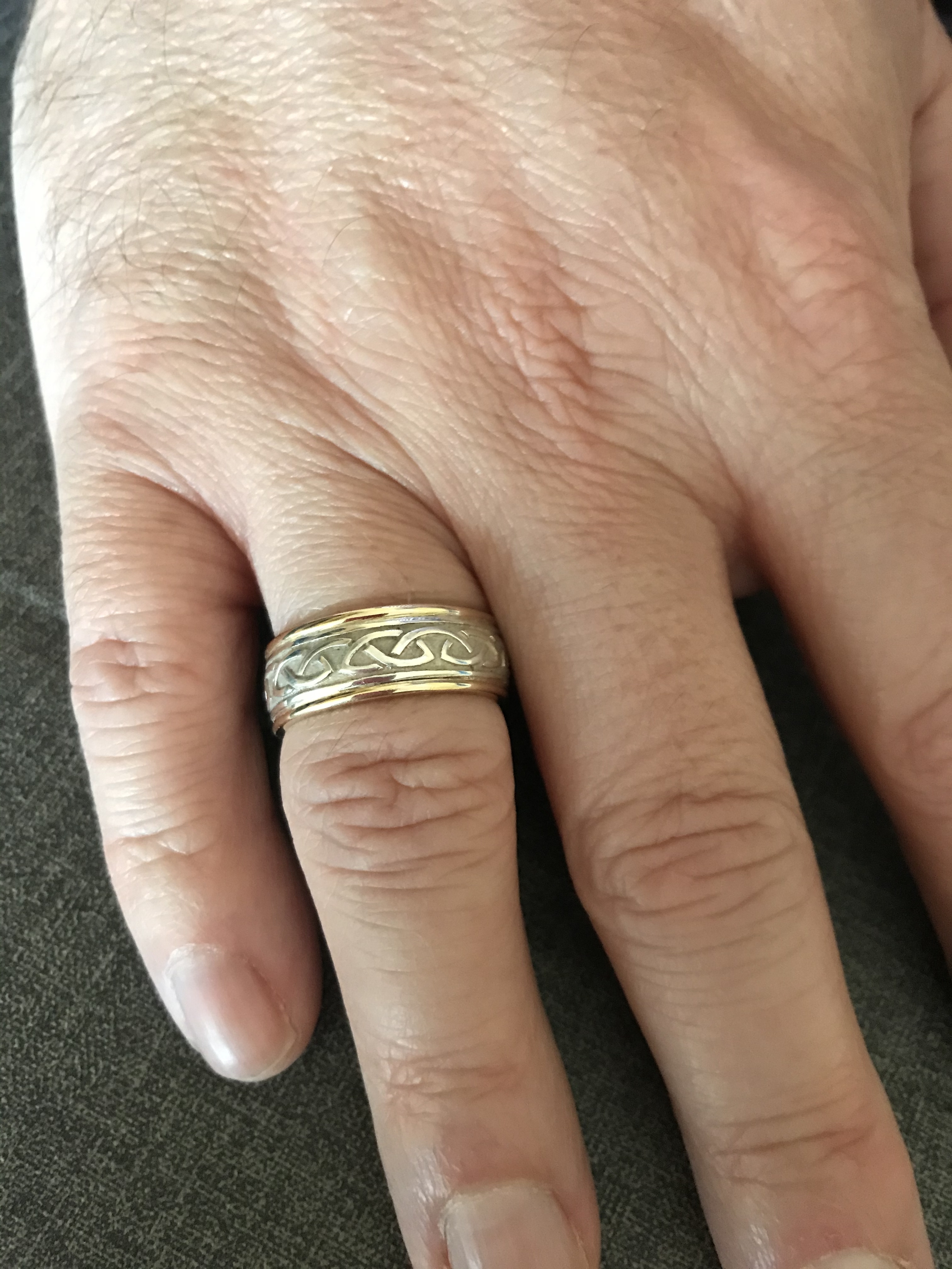 Silver & 10K Yellow Gold - 8mm